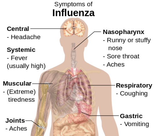Influenza/flu symptoms: headache, fever, achy joints, coughing, sneezing, sore throat, vomiting.