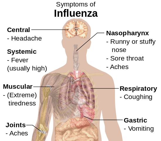 Influenza/flu symptoms: headache, fever, achy joints, coughing, sneezing, sore throat, vomiting.